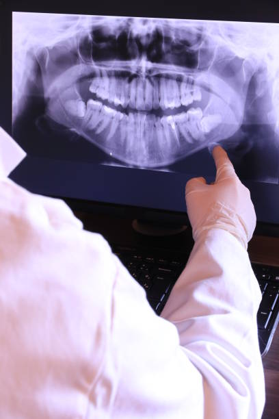 Best Emergency Dental Care for Abscessed Tooth in Short Hills, NJ