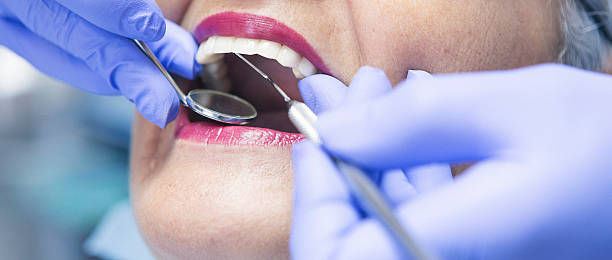 Best Emergency Dentist for Lost Fillings or Crowns in Short Hills, NJ